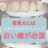 頑張ってないのに「なんか若々しい！」を目指す方へ◎口元の清潔感を引き出すメディカルホワイトニング