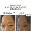 NRnineの筋膜リリースとお顔のケアで、健やかなお肌へ