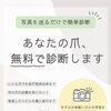 LINEで写真を送るだけ！大好評の「無料爪診断」をご存知ですか？
