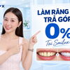 Nha khoa Phú Nhuận: Làm răng sứ trả góp 0% lãi suất tại Smilux Dental