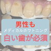 口元の清潔感を高めたい方へ◎施術前後の変化を実感するメディカルホワイトニング