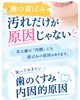 「ちゃんと歯磨きしているのに？歯科衛生士が教える歯の黄ばみ・くすみの「内側の原因」◎」