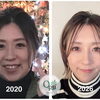 小顔矯正はなぜ「継続」がおすすめ？むくみにくくすっきりした状態を保つケアの秘訣
