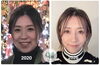 「小顔矯正はなぜ「継続」がおすすめ？むくみにくくすっきりした状態を保つケアの秘訣」