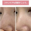 毛穴を広げる、黒ずませる油に要注意！