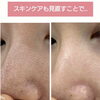 毛穴を広げる、黒ずませる油に要注意！