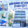 Dán sứ Veneer là gì? Ai phù hợp dán Veneer? | Nha khoa Smilux Dental Phú Nhuận