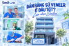 「Dán sứ Veneer là gì? Ai phù hợp dán Veneer? | Nha khoa Smilux Dental Phú Nhuận」