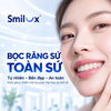 Bọc răng sứ loại nào tốt? Cách chọn dòng sứ phù hợp tại Smilux Dental Phú Nhuận