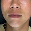 顔まわりをまとめてスッキリ✨FACE全部位セット6,000円でツルツル素肌を目指しませんか❓