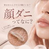 健やかな素肌を目指して。知っておきたい「顔ダニ」と艶肌WAXによる毛穴ケア