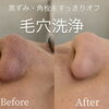 鼻のザラつき、つい触ってしまう方へ🫧福島駅近くで受けられるPOLAの毛穴ケア♪