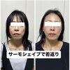 たるみお任せ下さい