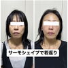 サーモシェイプ一回直後「たるみお任せ下さい」