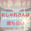 初めてでも安心◎しみや痛みが不安な方に寄り添うメディカルホワイトニング♪