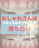 「初めてでも安心◎しみや痛みが不安な方に寄り添うメディカルホワイトニング♪」