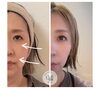 「「こうなりたい」を一緒に見つける｜鏡や写真で確認しながら進める小顔カウンセリング」