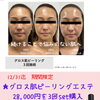 年末年始に向けて素肌を磨く♪グロス肌ピーリングエステ特別キャンペーン！豪華ホームケア特典付き