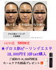 年末年始のお出掛け前に今から始める美肌作り！「年末年始に向けて素肌を磨く♪グロス肌ピーリングエステ特別キャンペーン！豪華ホームケア特典付き」