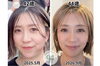 「笑ったときや話すときの輪郭が気になる方へ｜表情の動きに合わせたやさしい小顔ケア」