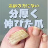 厚くなった足爪のお悩み、ご家族だけで抱え込まずにご相談ください