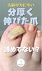 「厚くなった足爪のお悩み、ご家族だけで抱え込まずにご相談ください」