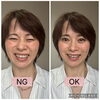 「笑ったときのシワが気になる方へ｜鼻まわりの表情癖を見直して頬で笑うセルフケア」