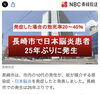 「長崎県内での日本脳炎患者の発生報道を受けて｜感染経路と基本的な予防について」
