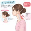 肩コリからくる意外な症状！