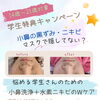 中高生の毛穴の黒ずみ、エステで解消できる？ 【Ｒ8.12/29迄の学生特典あり！】【小鼻洗浄・水素で同時にニキビケア・リ・セルは学生さんも多いエステサロン】