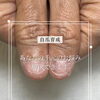 あなたのお悩み解決できます【福井市/自爪育成】