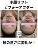 「40代以上の女性へ。思わず眠ってしまう小顔リフト！むくみまでスッキリ！」