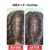 相談しながら整える頭皮のシャドウ表現｜周囲になじむ自然な仕上がりを目指すスカルプインク