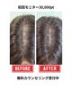 「相談しながら整える頭皮のシャドウ表現｜周囲になじむ自然な仕上がりを目指すスカルプインク」