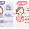 PCOS・子宮筋腫・FSH高値でお悩みの方が、漢方で体質改善に取り組み、体外受精で妊娠された症例