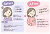 「PCOS・子宮筋腫・FSH高値でお悩みの方が、漢方で体質改善に取り組み、体外受精で妊娠された症例」