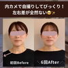 老け見えの原因は左右差⁉️