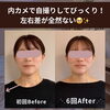 老け見えの原因は左右差⁉️