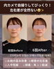「老け見えの原因は左右差⁉️」