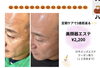 「美顔器エステ」