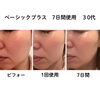 乾燥肌やスキンケアの悩みに！肌育サロンのスキンケア診断