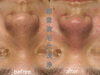 「超音波毛穴洗浄のBefore・After✨ 毛穴汚れをすっきり整えて滑らかな素肌へ🌿 海南市エステサロン」