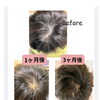 髪育ケア®︎でこれからに自信！