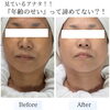 60代のお客様の施術変化＊首元からのケアでお顔もふっくら、明るい艶肌へ