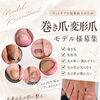 【先着10名様限定】巻き爪・変形爪のフットケアモデル様を募集いたします♪