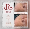 しわ ほうれい線にも 東区安いエステ Revi 陶肌トリートメント Revi認定サロン まつ毛エクステ 2bバイオプランタトリートメント Akikoのニュース まいぷれ 浜松市