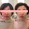 お口の整体「お口の整体」