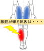 殿筋の硬さが原因。意外と多いんですよ「夜中にふくらはぎが攣るのは、お尻が固いから」