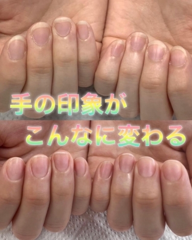 「爪 ピンクの部分 ガタガタ！　爪のコンプレックス改善に特化したネイルサロン☆」
