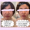 お口の整体「お口の整体　モニターさま」